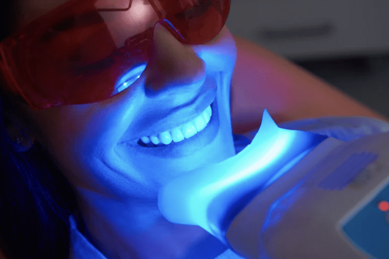 Porcelain Teeth Whitening AZ
