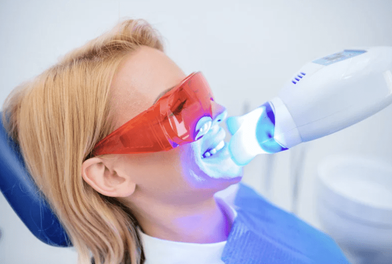 Best Porcelain Teeth Whitening AZ
