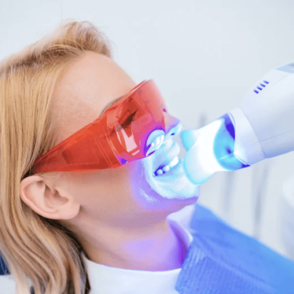 Best Porcelain Teeth Whitening AZ